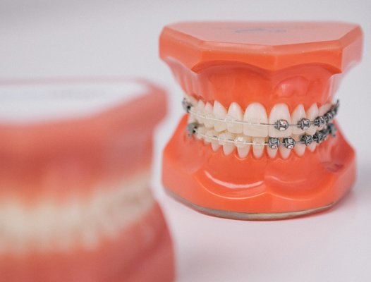 ortodoncia, dentista, brackets, dentista surco, dentista lima