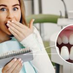 carillas dentales, dentistas