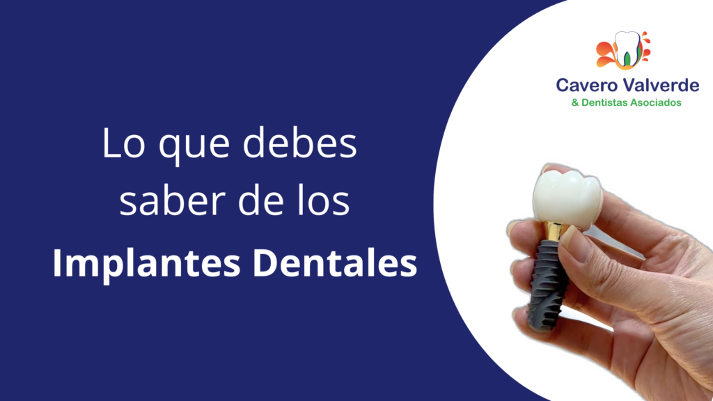 implante dental, implantes dentales, me falta un diente